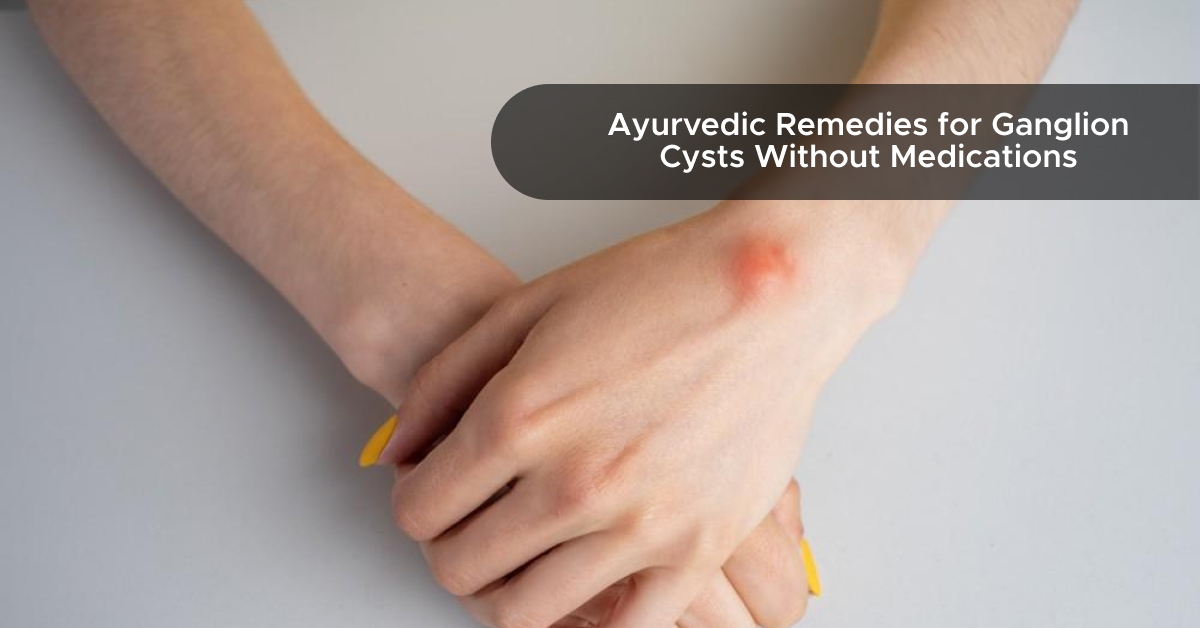 Ayurvedic Remedies for Ganglion Cysts Without Medications