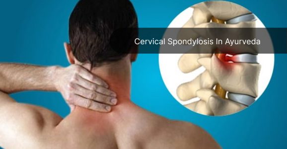 Cervical Spondylosis In Ayurveda