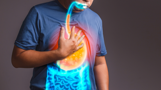 GERD Treatment in Ayurveda: A Comprehensive Guide